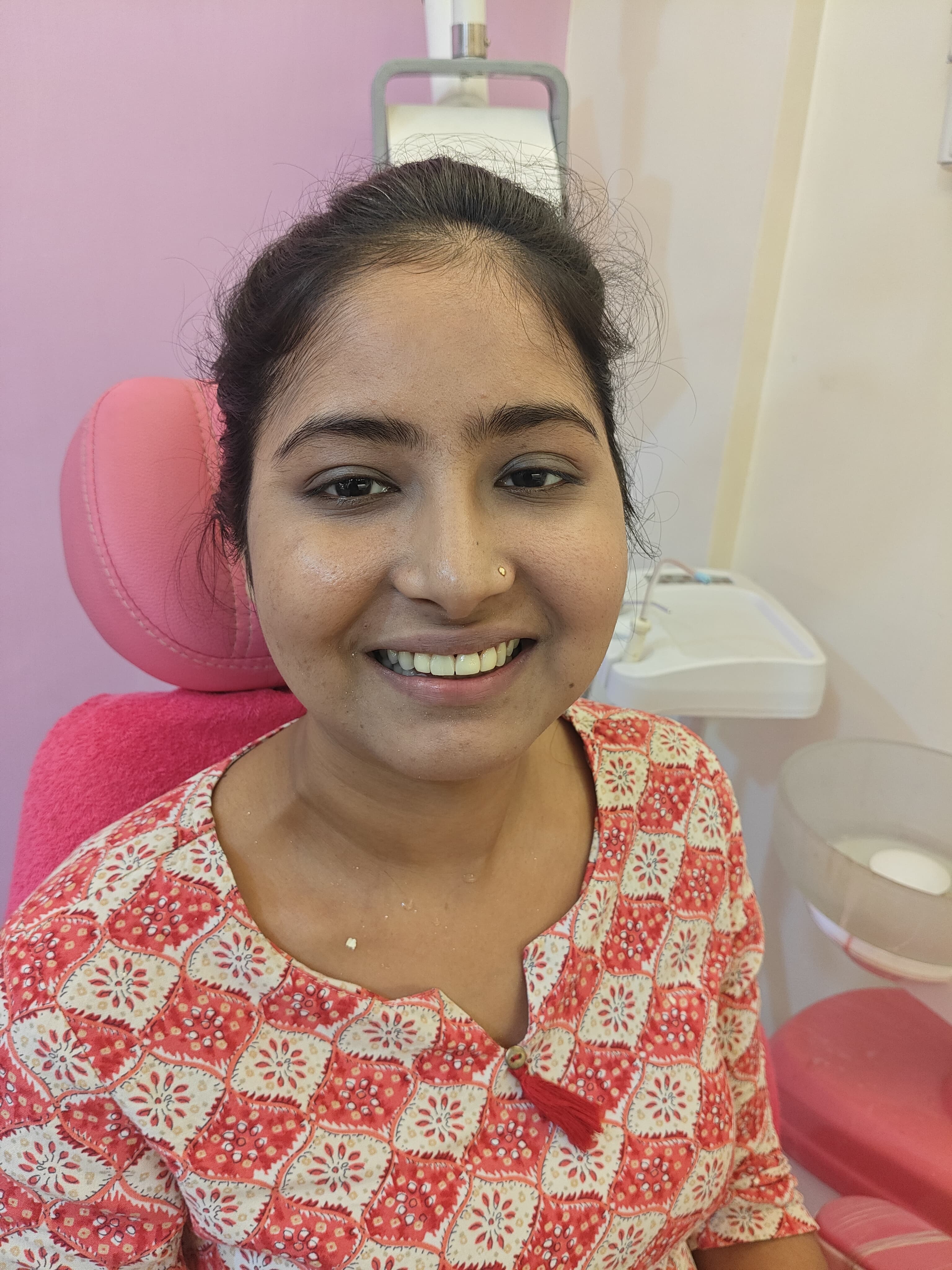 Smile Transformation Case 3